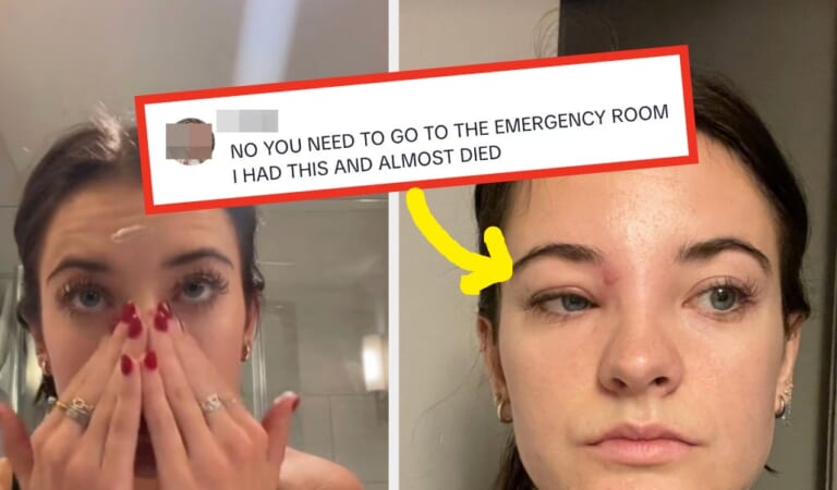 This "Dance Moms" Star Just Warned Millions About The Dangers Of Popping Pimples In The "Triangle Of Death," And It's Alarming