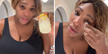 Serena Williams Puts Her Own Breast Milk On Sunburns