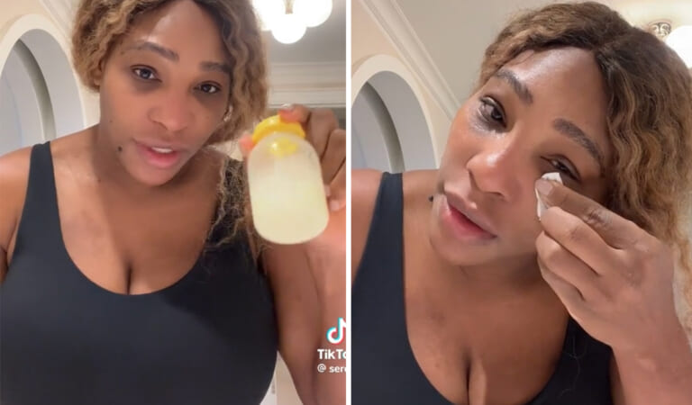 Serena Williams Puts Her Own Breast Milk On Sunburns! WHAT?!