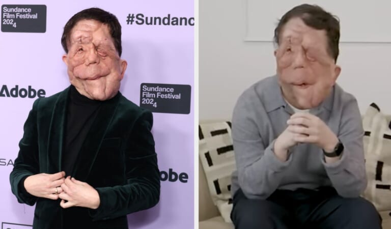 A Different Man’s Adam Pearson On Actors With Disabilites