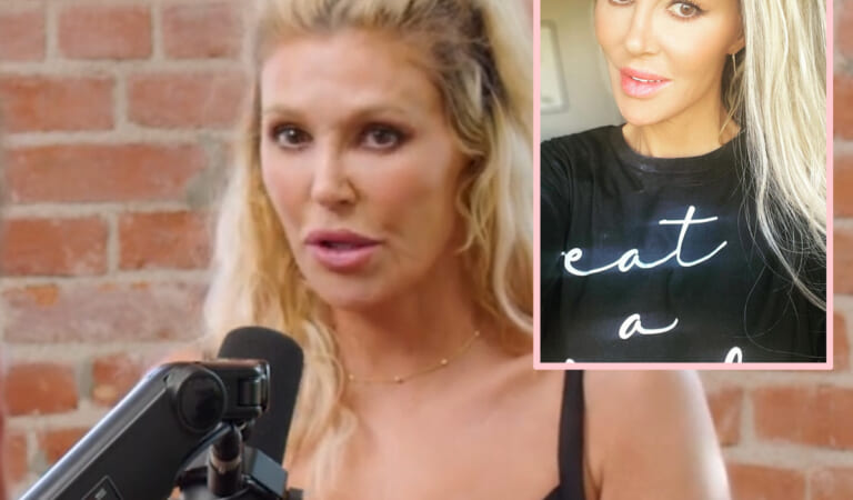 Brandi Glanville Was REJECTED For A Facelift?! Huh???