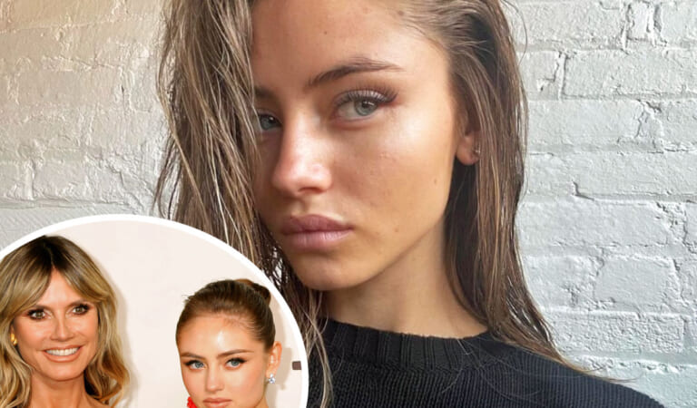 Heidi Klum’s Model Daughter Leni Shares Makeup-Free Face Covered In Acne!