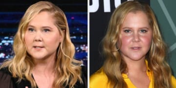Amid Heaps Of Speculation Around Her Appearance, Amy Schumer Addressed Criticism Of Her "Puffier" Face And Shared A Raw Health Update