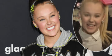 JoJo Siwa Dropped $50,000 On A Cosmetic Procedure! Can You Tell What She Had Done??