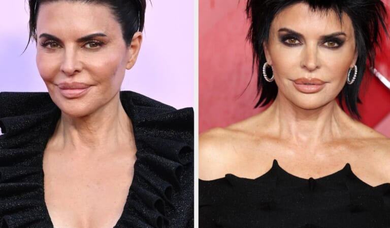 Lisa Rinna Reacts To Criticism Of Excessive Face Filler